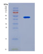 SDS-PAGE analysis of Mouse Fibroblast Growth Factor 7 (FGF7) - Recombinant Protein, CAT# BLT-08521P showing >90% purity under 15% SDS-PAGE (Reduced)
