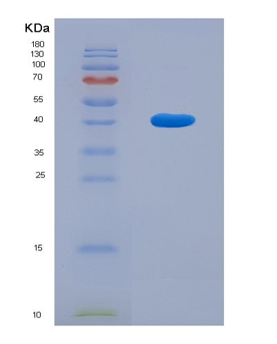 SDS-PAGE analysis of Mouse Bdnf (Neurotrophic Factor Bdnf Precursor Form) - Recombinant Protein, CAT# BLT-08522P showing >90% purity under 15% SDS-PAGE (Reduced)
