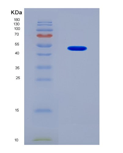 SDS-PAGE analysis of Mouse Krt18 (Keratin, Type I Cytoskeletal 18) - Recombinant Protein, CAT# BLT-08523P showing >90% purity under 15% SDS-PAGE (Reduced)