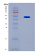 SDS-PAGE analysis of Mouse Krt18 (Keratin, Type I Cytoskeletal 18) - Recombinant Protein, CAT# BLT-08523P showing >90% purity under 15% SDS-PAGE (Reduced)