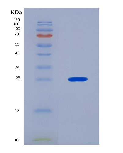 SDS-PAGE analysis of Human IFNB1 (Interferon Beta) - Recombinant Protein, CAT# BLT-08524P showing >90% purity under 15% SDS-PAGE (Reduced)