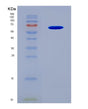 SDS-PAGE analysis of Human KCNAB1 (Voltage-Gated Potassium Channel Subunit Beta-1) - Recombinant Protein, CAT# BLT-08529P showing >90% purity under 15% SDS-PAGE (Reduced)