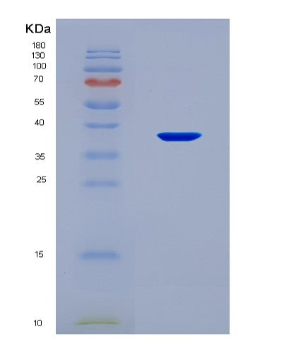 SDS-PAGE analysis of Human IL22RA1 (Interleukin-22 Receptor Subunit Alpha-1) - Recombinant Protein, CAT# BLT-08533P showing >90% purity under 15% SDS-PAGE (Reduced)