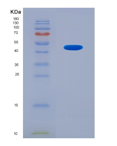 SDS-PAGE analysis of Human COL5A2 (Collagen Alpha-2(V) Chain) - Recombinant Protein, CAT# BLT-08537P showing >90% purity under 15% SDS-PAGE (Reduced)