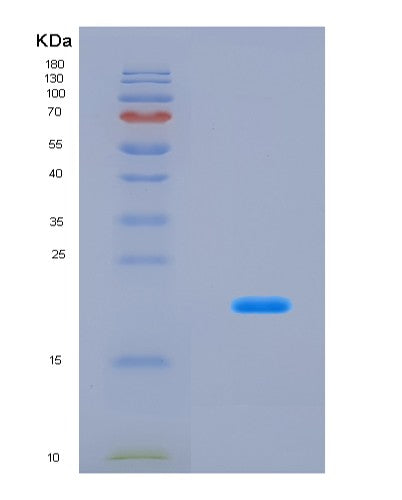 SDS-PAGE analysis of Mouse Rps19 (Small Ribosomal Subunit Protein Es19) - Recombinant Protein, CAT# BLT-08540P showing >90% purity under 15% SDS-PAGE (Reduced)