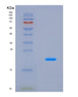 SDS-PAGE analysis of Mouse Rps19 (Small Ribosomal Subunit Protein Es19) - Recombinant Protein, CAT# BLT-08540P showing >90% purity under 15% SDS-PAGE (Reduced)