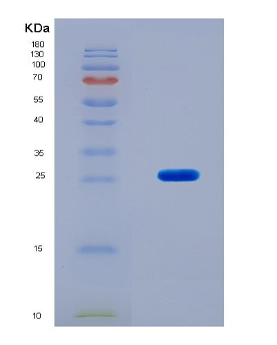 SDS-PAGE analysis of Human CFD (Complement Factor D) - Recombinant Protein, CAT# BLT-08547P showing >90% purity under 15% SDS-PAGE (Reduced)