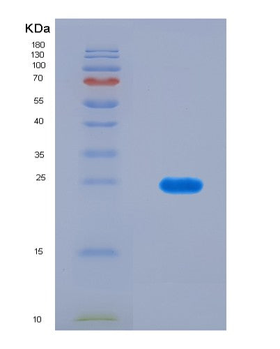 SDS-PAGE analysis of Human RERGL (Ras-Related And Estrogen-Regulated Growth Inhibitor-Like Protein) - Recombinant Protein, CAT# BLT-08548P showing >90% purity under 15% SDS-PAGE (Reduced)