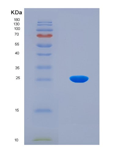 SDS-PAGE analysis of Human KAT2B (Histone Acetyltransferase Kat2B) - Recombinant Protein, CAT# BLT-08538P showing >90% purity under 15% SDS-PAGE (Reduced)