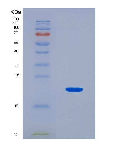 SDS-PAGE analysis of Human SLC5A1 (Sodium/Glucose Cotransporter 1) - Recombinant Protein, CAT# BLT-08552P showing >90% purity under 15% SDS-PAGE (Reduced)