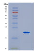 SDS-PAGE analysis of Human SLC5A1 (Sodium/Glucose Cotransporter 1) - Recombinant Protein, CAT# BLT-08552P showing >90% purity under 15% SDS-PAGE (Reduced)