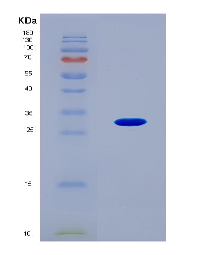 SDS-PAGE analysis of Human RNF123 (E3 Ubiquitin-Protein Ligase Rnf123) - Recombinant Protein, CAT# BLT-08557P showing >90% purity under 15% SDS-PAGE (Reduced)