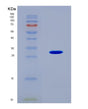 SDS-PAGE analysis of Human RNF123 (E3 Ubiquitin-Protein Ligase Rnf123) - Recombinant Protein, CAT# BLT-08557P showing >90% purity under 15% SDS-PAGE (Reduced)