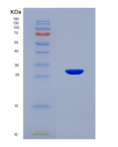SDS-PAGE analysis of Human RNF123 (E3 Ubiquitin-Protein Ligase Rnf123) - Recombinant Protein, CAT# BLT-08558P showing >90% purity under 15% SDS-PAGE (Reduced)