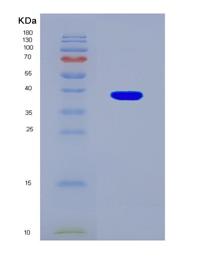 SDS-PAGE analysis of Human PRPS1 (Ribose-Phosphate Pyrophosphokinase 1) - Recombinant Protein, CAT# BLT-08559P showing >90% purity under 15% SDS-PAGE (Reduced)