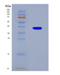 SDS-PAGE analysis of Human PRPS1 (Ribose-Phosphate Pyrophosphokinase 1) - Recombinant Protein, CAT# BLT-08559P showing >90% purity under 15% SDS-PAGE (Reduced)