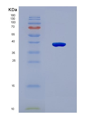 SDS-PAGE analysis of Human PRPS2 (Ribose-Phosphate Pyrophosphokinase 2) - Recombinant Protein, CAT# BLT-08560P showing >90% purity under 15% SDS-PAGE (Reduced)