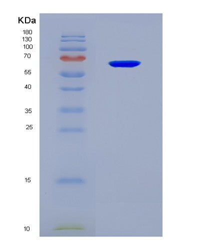 SDS-PAGE analysis of Human Stress-induced-phospho- Recombinant Protein 1(Stip1) - Recombinant Protein, CAT# BLT-08561P showing >90% purity under 15% SDS-PAGE (Reduced)