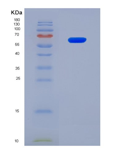SDS-PAGE analysis of Human DLL3 (Delta-Like Protein 3) - Recombinant Protein, CAT# BLT-08564P showing >90% purity under 15% SDS-PAGE (Reduced)