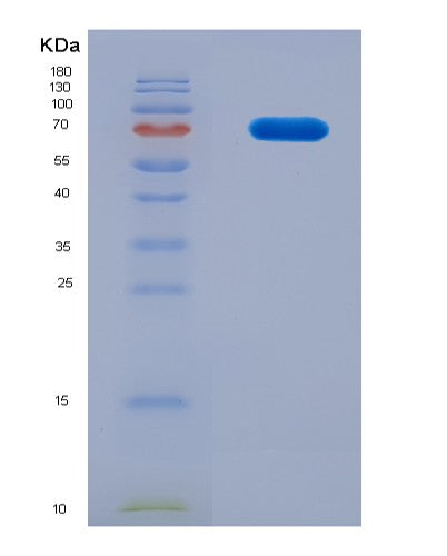 SDS-PAGE analysis of Mouse Hspa9 (Stress-70 Protein, Mitochondrial) - Recombinant Protein, CAT# BLT-08566P showing >90% purity under 15% SDS-PAGE (Reduced)