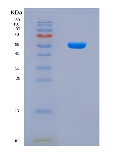 SDS-PAGE analysis of Human TRIM38 (E3 Ubiquitin-Protein Ligase Trim38) - Recombinant Protein, CAT# BLT-08554P showing >90% purity under 15% SDS-PAGE (Reduced)