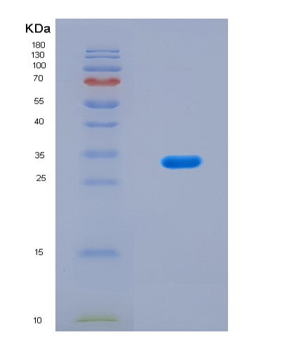 SDS-PAGE analysis of Mouse Ogdh (2-Oxoglutarate Dehydrogenase Complex Component E1) - Recombinant Protein, CAT# BLT-08569P showing >90% purity under 15% SDS-PAGE (Reduced)
