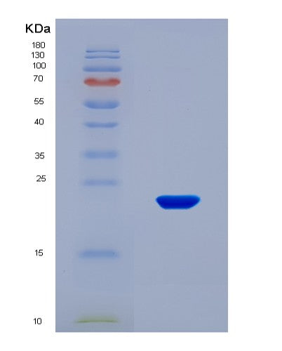 SDS-PAGE analysis of Mouse Lama1 (Laminin Subunit Alpha-1) - Recombinant Protein, CAT# BLT-08572P showing >90% purity under 15% SDS-PAGE (Reduced)