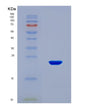 SDS-PAGE analysis of Mouse Lama1 (Laminin Subunit Alpha-1) - Recombinant Protein, CAT# BLT-08572P showing >90% purity under 15% SDS-PAGE (Reduced)