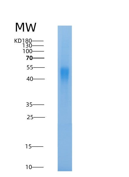 SDS-PAGE analysis of Human PPT2 (Lysosomal Thioesterase Ppt2) - Recombinant Protein, CAT# BLT-08574P showing >90% purity under 15% SDS-PAGE (Reduced)