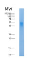SDS-PAGE analysis of Human PPT2 (Lysosomal Thioesterase Ppt2) - Recombinant Protein, CAT# BLT-08574P showing >90% purity under 15% SDS-PAGE (Reduced)
