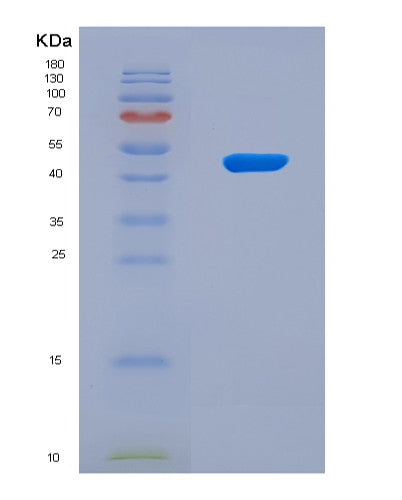 SDS-PAGE analysis of Human FOXO3 (Forkhead Box Protein O3) - Recombinant Protein, CAT# BLT-08575P showing >90% purity under 15% SDS-PAGE (Reduced)