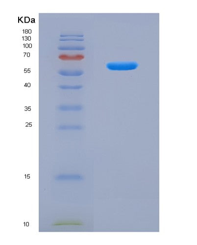 SDS-PAGE analysis of Human CUL2 (Cullin-2) - Recombinant Protein, CAT# BLT-08578P showing >90% purity under 15% SDS-PAGE (Reduced)