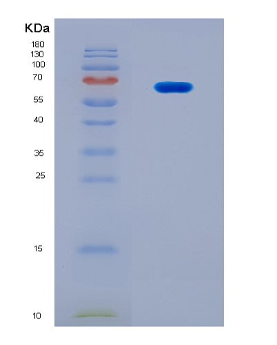 SDS-PAGE analysis of Human FARSA (Phenylalanine--Trna Ligase Alpha Subunit) - Recombinant Protein, CAT# BLT-08579P showing >90% purity under 15% SDS-PAGE (Reduced)