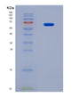SDS-PAGE analysis of Human FARSA (Phenylalanine--Trna Ligase Alpha Subunit) - Recombinant Protein, CAT# BLT-08579P showing >90% purity under 15% SDS-PAGE (Reduced)