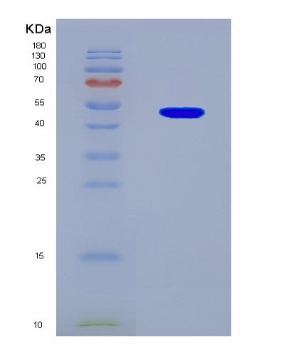 SDS-PAGE analysis of Human E2F1 (Transcription Factor E2F1) - Recombinant Protein, CAT# BLT-08581P showing >90% purity under 15% SDS-PAGE (Reduced)