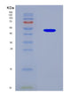 SDS-PAGE analysis of Human E2F1 (Transcription Factor E2F1) - Recombinant Protein, CAT# BLT-08581P showing >90% purity under 15% SDS-PAGE (Reduced)