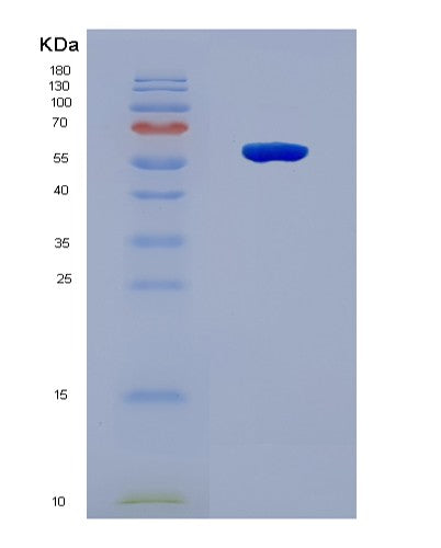 SDS-PAGE analysis of Human RGS6 (Regulator Of G-Protein Signaling 6) - Recombinant Protein, CAT# BLT-08582P showing >90% purity under 15% SDS-PAGE (Reduced)