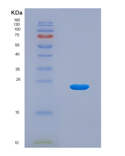 SDS-PAGE analysis of Human DMKN (Dermokine) - Recombinant Protein, CAT# BLT-08583P showing >90% purity under 15% SDS-PAGE (Reduced)