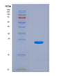 SDS-PAGE analysis of Human DMKN (Dermokine) - Recombinant Protein, CAT# BLT-08583P showing >90% purity under 15% SDS-PAGE (Reduced)