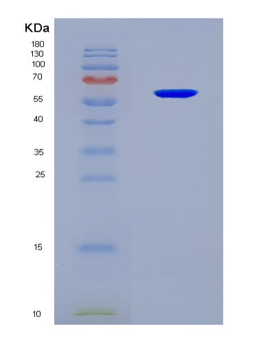 SDS-PAGE analysis of Human RBMY1A1 (Rna-Binding Motif Protein, Y Chromosome, Family 1 Member A1) - Recombinant Protein, CAT# BLT-08584P showing >90% purity under 15% SDS-PAGE (Reduced)
