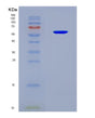 SDS-PAGE analysis of Human RBMY1A1 (Rna-Binding Motif Protein, Y Chromosome, Family 1 Member A1) - Recombinant Protein, CAT# BLT-08584P showing >90% purity under 15% SDS-PAGE (Reduced)