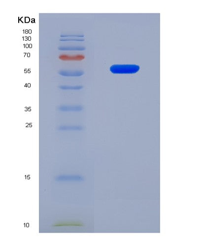 SDS-PAGE analysis of Mouse Membrane-associated tyrosine- and threonine-specific cdc2-inhibitory kinase (PKMYT1) - Recombinant Protein, CAT# BLT-08586P showing >90% purity under 15% SDS-PAGE (Reduced)