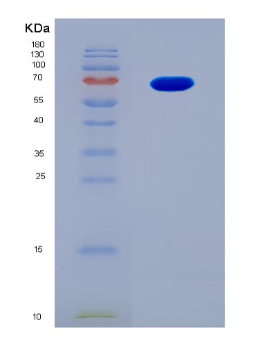 SDS-PAGE analysis of Human Mitogen Activated Kinase Kinase 1 (MAP2K1) - Recombinant Protein, CAT# BLT-08587P showing >90% purity under 15% SDS-PAGE (Reduced)