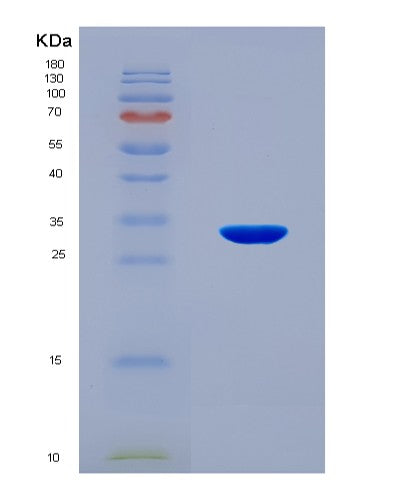 SDS-PAGE analysis of Mouse Gsk3b (Glycogen Synthase Kinase-3 Beta) - Recombinant Protein, CAT# BLT-08588P showing >90% purity under 15% SDS-PAGE (Reduced)