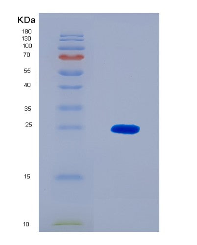 SDS-PAGE analysis of Human PCM1 (Pericentriolar Material 1 Protein) - Recombinant Protein, CAT# BLT-08592P showing >90% purity under 15% SDS-PAGE (Reduced)
