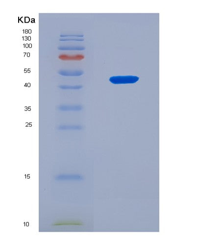 SDS-PAGE analysis of Human OLFML1 (Olfactomedin-Like Protein 1) - Recombinant Protein, CAT# BLT-08600P showing >90% purity under 15% SDS-PAGE (Reduced)