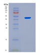 SDS-PAGE analysis of Human OLFML1 (Olfactomedin-Like Protein 1) - Recombinant Protein, CAT# BLT-08600P showing >90% purity under 15% SDS-PAGE (Reduced)