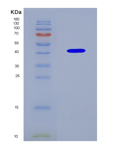 SDS-PAGE analysis of Human EGFR (Epidermal Growth Factor Receptor) - Recombinant Protein, CAT# BLT-08603P showing >90% purity under 15% SDS-PAGE (Reduced)