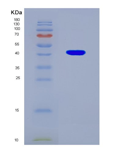 SDS-PAGE analysis of Human HPF1 (Histone Parylation Factor 1) - Recombinant Protein, CAT# BLT-08604P showing >90% purity under 15% SDS-PAGE (Reduced)