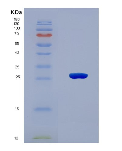 SDS-PAGE analysis of Human LAMB1 (Laminin Subunit Beta-1) - Recombinant Protein, CAT# BLT-08605P showing >90% purity under 15% SDS-PAGE (Reduced)